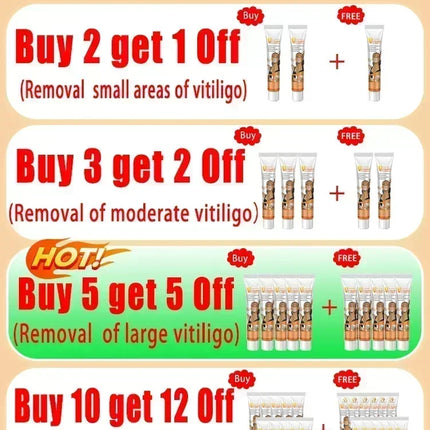 Vitiligo Cream For Vitiligo Sufferers Eelhoe Relief by zapcart