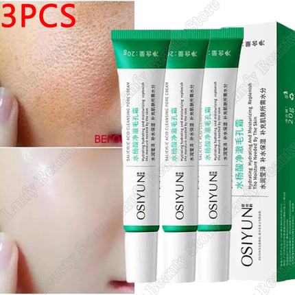 PWYUMAN Salicylic Acid Pore Clearing Cream Brighten Skin by zapcart