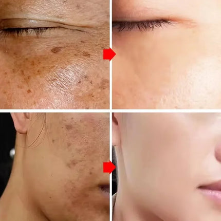 PWYUMAN Astragalus Whitening Freckles Cream For Women by zapcart