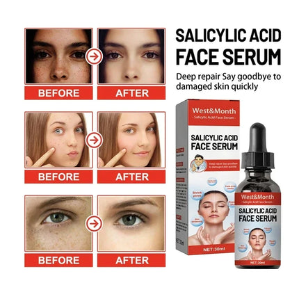 Niacinamide Facial Serum Brightening Pore Refining For All by zapcart