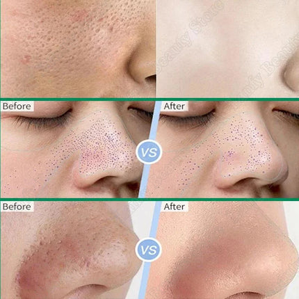 PWYUMAN Salicylic Acid Pore Clearing Cream Brighten Skin by zapcart