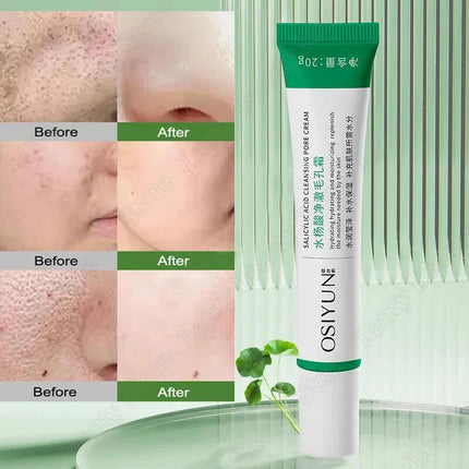 PWYUMAN Salicylic Acid Pore Clearing Cream Brighten Skin by zapcart