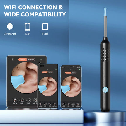 Sunuo Visual Ear Cleaner Otoscope 8MP Endoscope For Home by zapcart