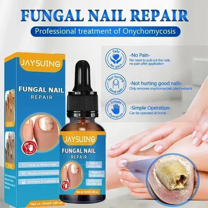 Toenail Fungus Treatment Device Fast Repair For Feet by zapcart
