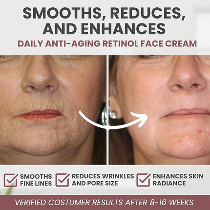 AFCARE Instant Retinol Cream For Wrinkles And Firming Women by zapcart