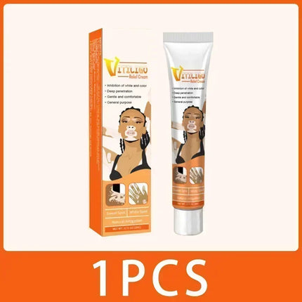 Vitiligo Cream For Vitiligo Sufferers Eelhoe Relief by zapcart