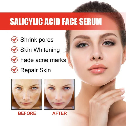 Niacinamide Facial Serum Brightening Pore Refining For All by zapcart