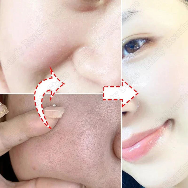 PWYUMAN Salicylic Acid Pore Clearing Cream Brighten Skin by zapcart