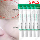 PWYUMAN Salicylic Acid Pore Clearing Cream Brighten Skin by zapcart
