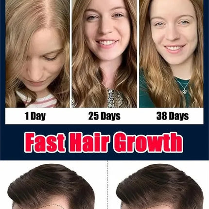 Natural Hair Growth Oil For Men And Women Fuller Hair by zapcart