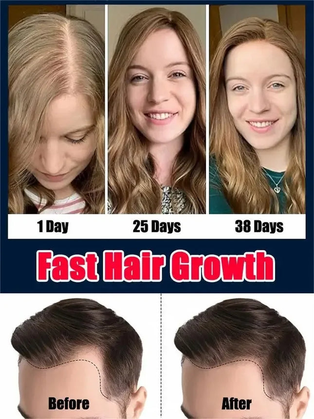 Natural Hair Growth Oil For Men And Women Fuller Hair by zapcart