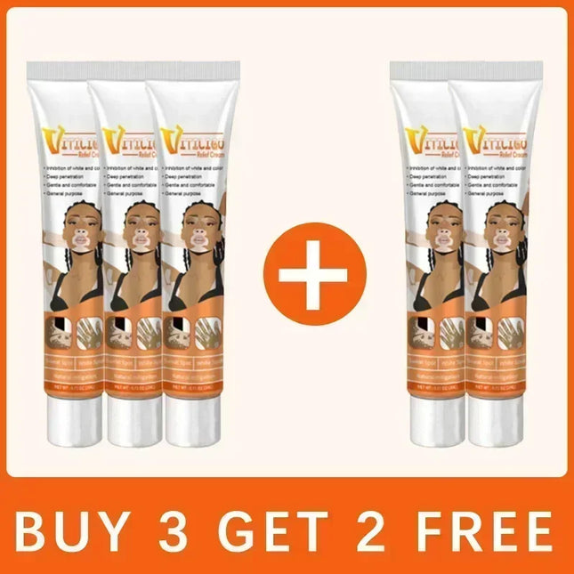 Vitiligo Cream For Vitiligo Sufferers Eelhoe Relief by zapcart