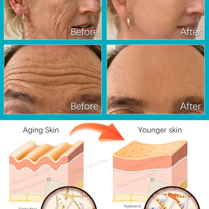 Wrinkles Disappear Anti Aging Serum For Busy Women Today by zapcart