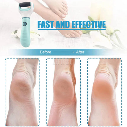 Choice Electric Foot Grinder Home Waterproof Pedicure Tool
