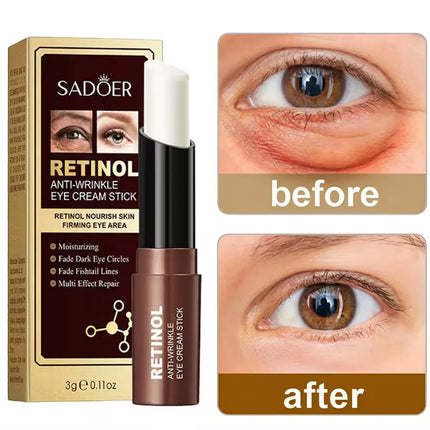 Eelhoe Eye Cream For Dark Circles And Fine Lines Glow by zapcart