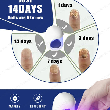 SLIBRIDGE Fungal Nail Repair Fast For Toenail Fungus by zapcart