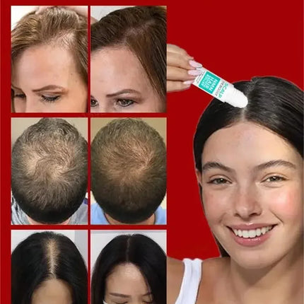 Natural Hair Growth Oil For Men And Women Fuller Hair by zapcart