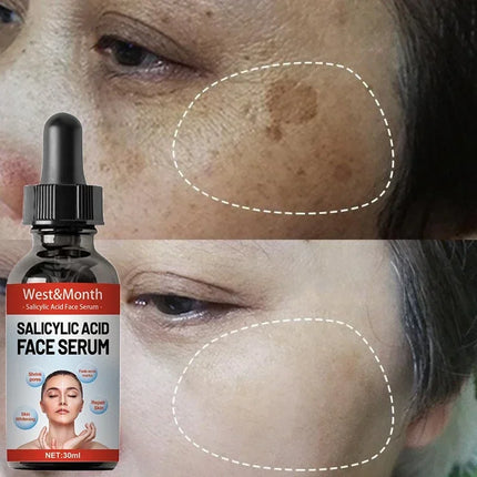 Niacinamide Facial Serum Brightening Pore Refining For All by zapcart