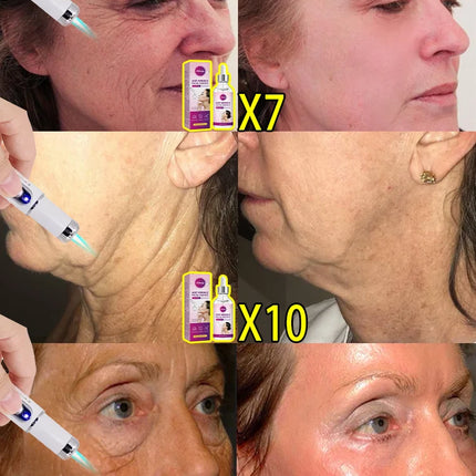 Korean Cosmetics Facial Firming Elevator For Women At Home by zapcart