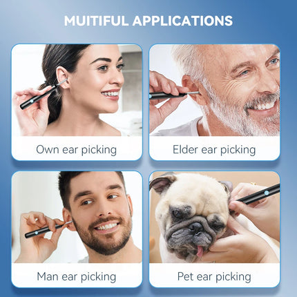 Sunuo Visual Ear Cleaner Otoscope 8MP Endoscope For Home by zapcart