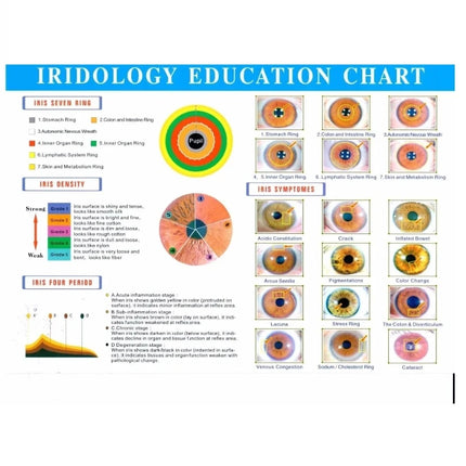 Suyzeko Iridology Digital Camera Clinics Iris Scanner 12MP by zapcart