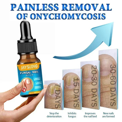 Toenail Fungus Treatment Device Fast Repair For Feet by zapcart
