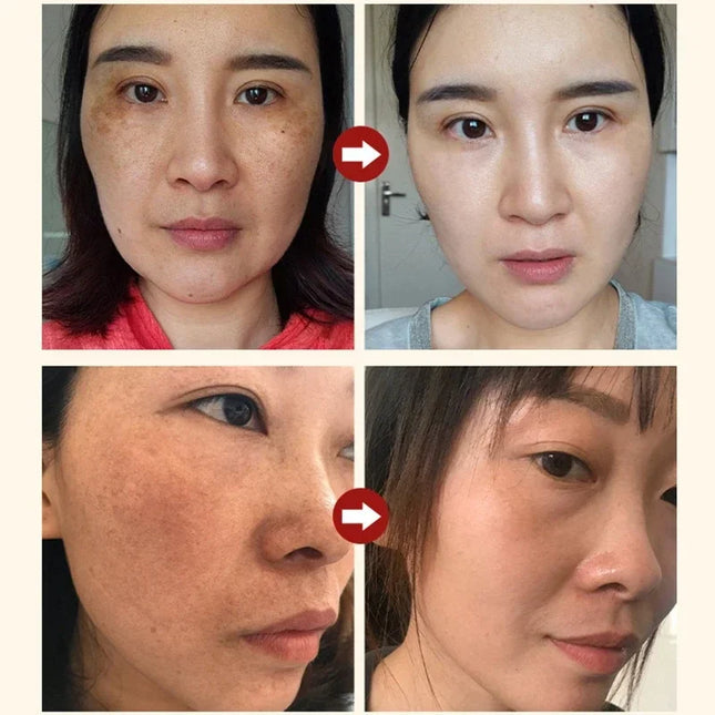 Niacinamide Facial Serum Brightening Pore Refining For All by zapcart