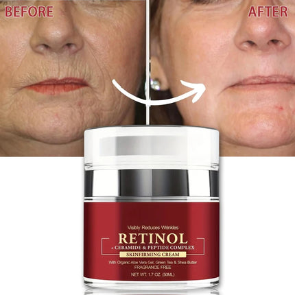 AFCARE Instant Retinol Cream For Wrinkles And Firming Women by zapcart