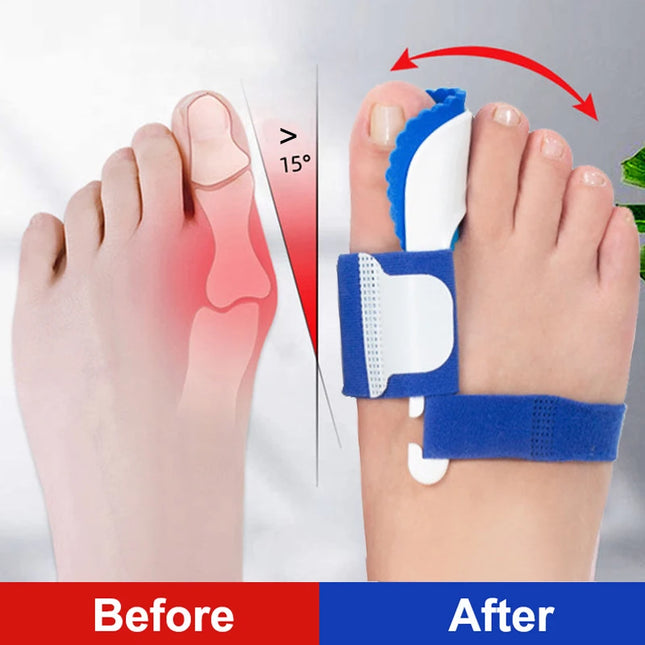 Bunion Brace Night Toe Corrector for Pain Relief Overnight by zapcart