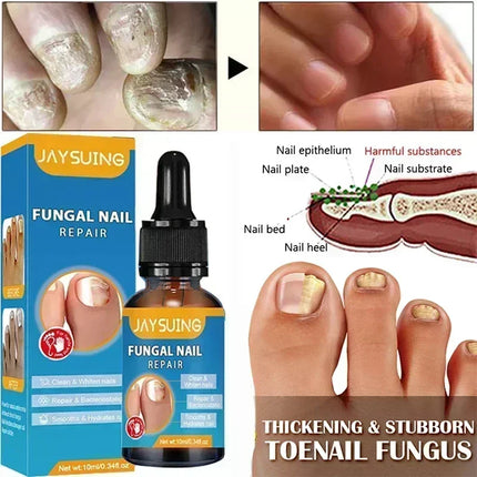 Toenail Fungus Treatment Device Fast Repair For Feet by zapcart