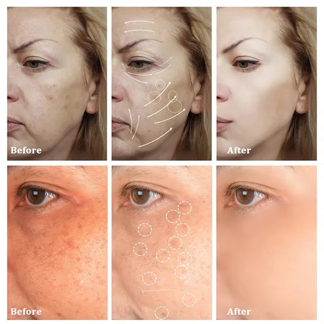 PWYUMAN Astragalus Whitening Freckles Cream For Women by zapcart