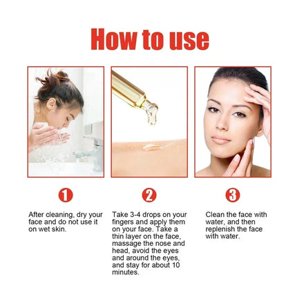 Niacinamide Facial Serum Brightening Pore Refining For All by zapcart