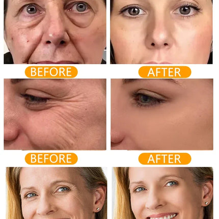 Wrinkles Disappear Anti Aging Serum For Busy Women Today by zapcart