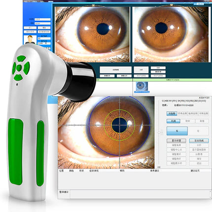 Suyzeko Iridology Digital Camera Clinics Iris Scanner 12MP by zapcart