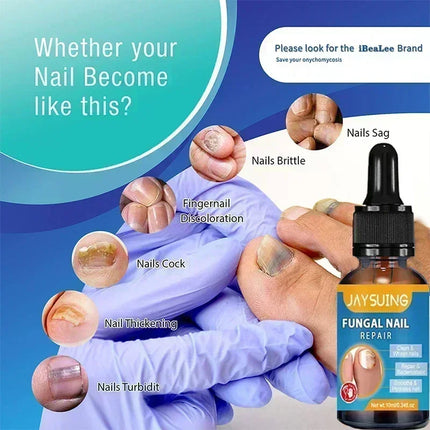 Toenail Fungus Treatment Device Fast Repair For Feet by zapcart