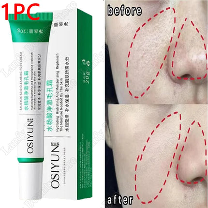 PWYUMAN Salicylic Acid Pore Clearing Cream Brighten Skin by zapcart