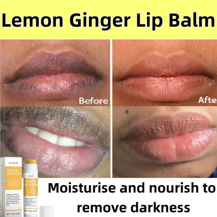 Ouhoe Korean Lip Care Lightening Mask Moisturizing For Women