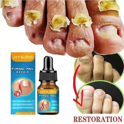 Toenail Fungus Treatment Device Fast Repair For Feet by zapcart