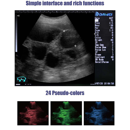 DAWEI Portable Veterinary Ultrasound Scanner for Farmers by zapcart