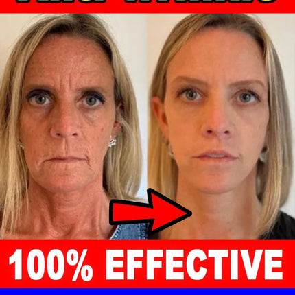 Wrinkles Disappear Anti Aging Serum For Busy Women Today by zapcart
