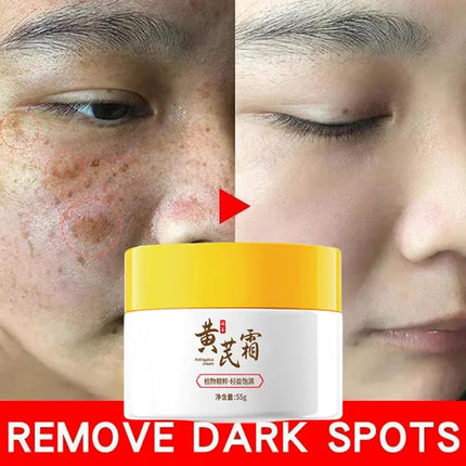 PWYUMAN Astragalus Whitening Freckles Cream For Women by zapcart