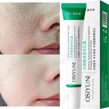 PWYUMAN Salicylic Acid Pore Clearing Cream Brighten Skin by zapcart