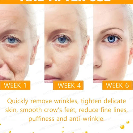 Wrinkles Disappear Anti Aging Serum For Busy Women Today by zapcart